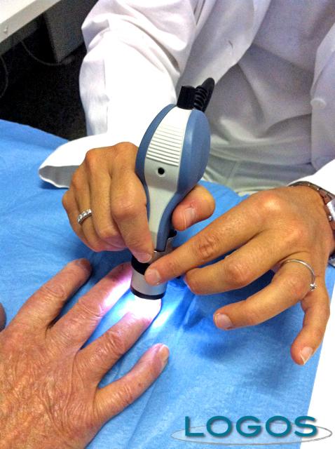 Salute - Capillaroscopia (Foto internet)