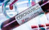 Salute - Coronavirus (Foto internet)