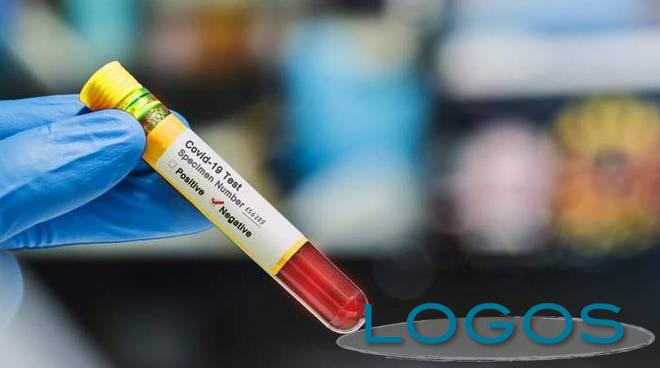 Salute - Coronavirus (Foto internet)