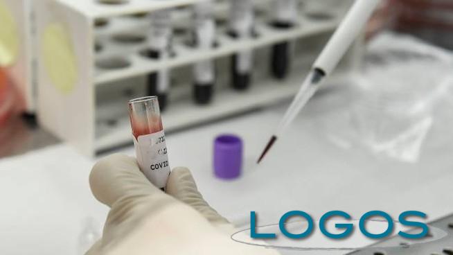 Salute - Test sierologici (Foto internet)