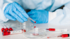 Salute - Test sierologici (Foto internet)