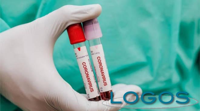 Salute - Emergenza Coronavirus (Foto internet)