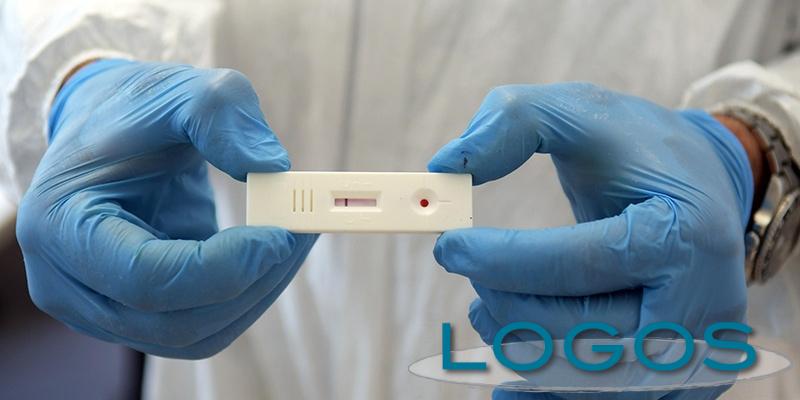 Salute - Test sierologici (Foto internet) Salute - Test sierologici (Foto internet)