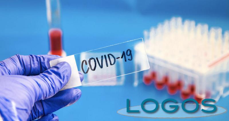 Salute - Test sierologici per il Covid-19 con prelievo