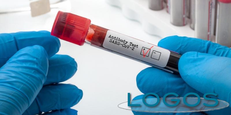 Salute - Test Covid (Foto internet)