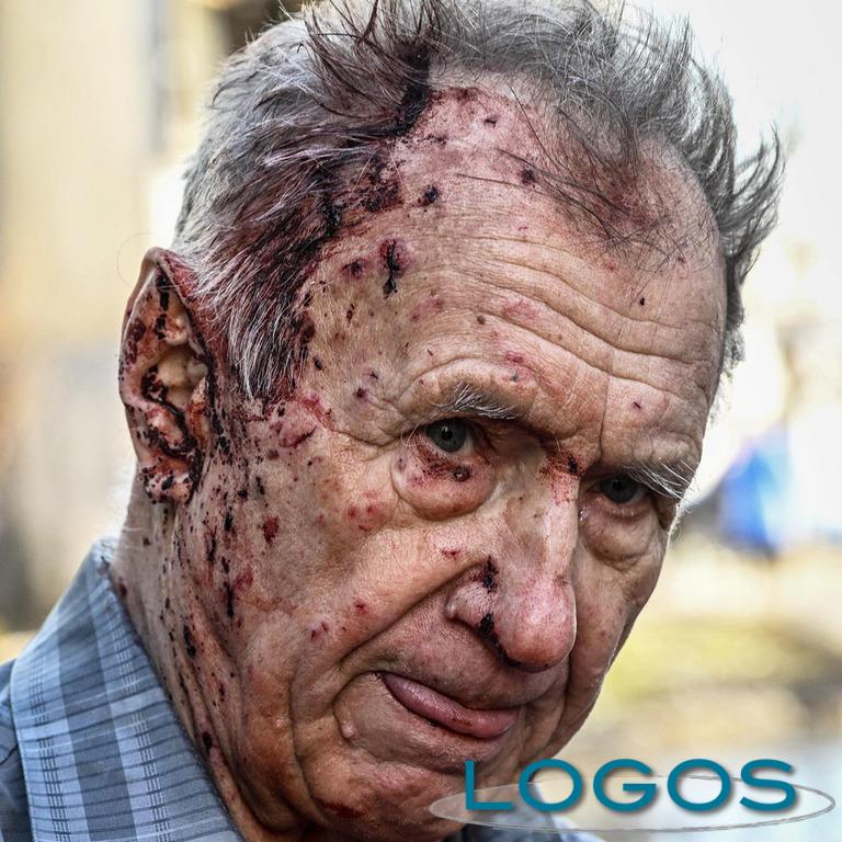 Sociale - Cittadino ucraino colpito negli attacchi Sociale - Cittadino ucraino colpito negli attacchi